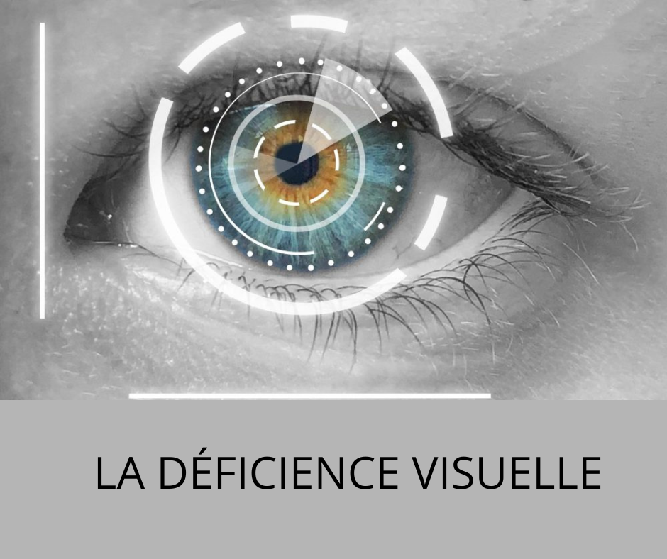 Renseignez vous sur la déficience visuelle en cliquant sur cette image Renseignez vous sur la déficience visuelle en cliquant sur cette image